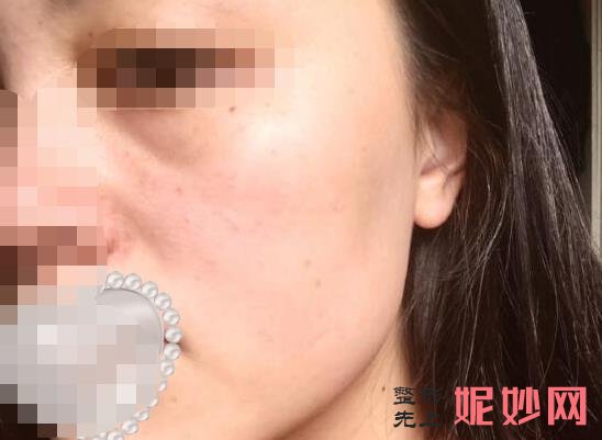 西安晶肤医疗美容医院做祛斑好不好？医院介绍附祛斑案例和价格表！