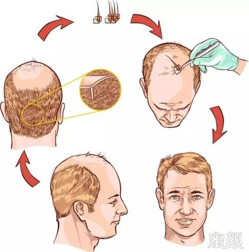 上海九院陈教授是谁？医生擅长做那些项目？内附隆鼻案例图分享