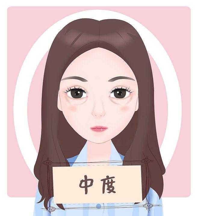 上海九院陈教授是谁？医生擅长做那些项目？内附隆鼻案例图分享