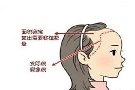 上海九院陈教授是谁？医生擅长做那些项目？内附隆鼻案例图分享