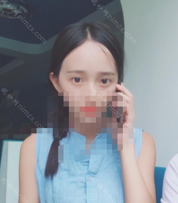 上海九院刘菲做的双眼皮好吗？有谁做过？院内眼部整形优质案例