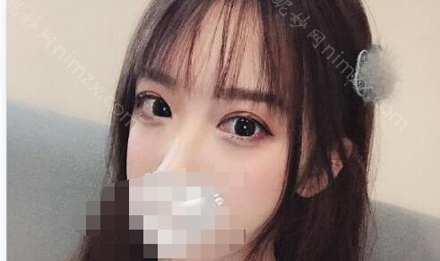 上海九院眼综合整形价目表2021揭晓！内附真人术后恢复图分享
