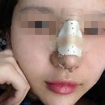 蒋思军做鼻综合怎么样？蒋思军做鼻综合技术好吗？