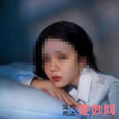 韦小勇医生做鼻子技术到底怎么样？_内附隆鼻案例分享_隆鼻价格表
