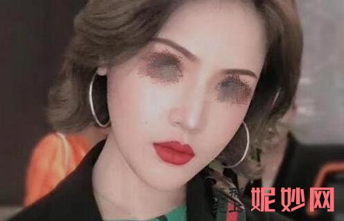 广州华美李文峰做鼻子技术评价怎么样？医生介绍附做鼻子案例和价格表！