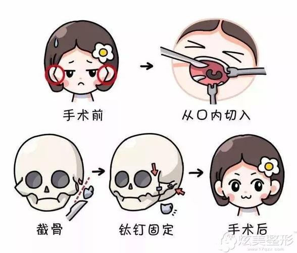 「北京协和医院整形美容外科刘志飞」怎么样?擅长|案例|价格表