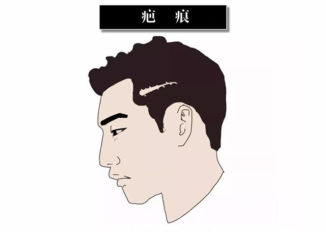 「北京蕾士悦医疗美容诊所金尚训」怎么样?擅长|案例|价格表