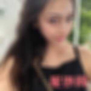 西安第四军医大学西京医院整形美容外科怎么样?