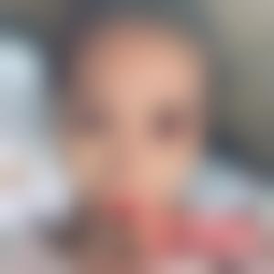 「长沙亚韩医学美容医院徐敬宾」怎么样?擅长|案例|价格表