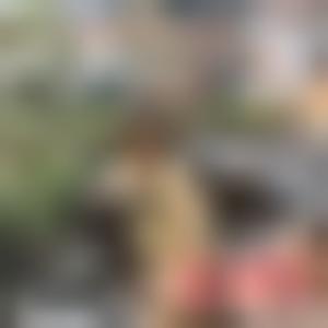 「深圳北大医院整形科何君君」怎么样?擅长|案例|价格表