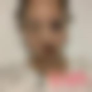 「北京苏亚医疗美容医院王珊珊」怎么样?擅长|案例|价格表