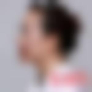 「北京苏亚医疗美容医院王小萌」怎么样?擅长|案例|价格表