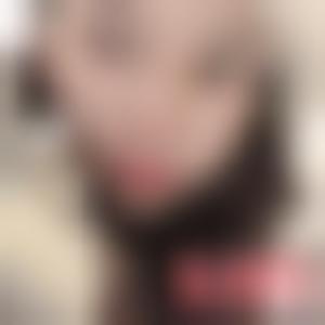 「北京苏亚医疗美容医院雷红」怎么样?擅长|案例|价格表
