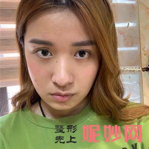 福州艾丽莎整形美容医院是正规医院吗?附2021较新整形案例