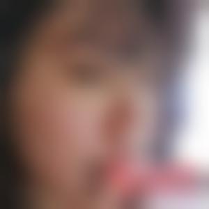 「无锡丽都（原瑞丽）医疗美容医院」怎么样?正规吗|案例|价格表