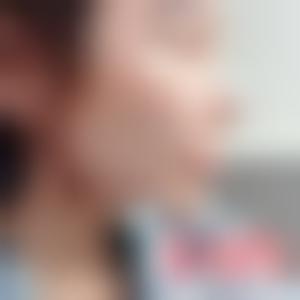 「北京嘉禾医疗美容王禹」怎么样?擅长|案例|价格表