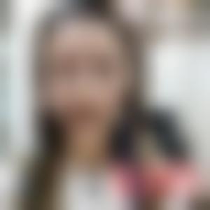 「无锡丽都（原瑞丽）医疗美容医院吴豫芳」怎么样?擅长|案例|价格表