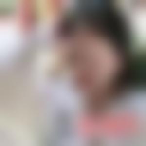 「成都润美玉之光医疗美容整形门诊部」怎么样?正规吗|案例|价格表