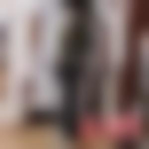 「​四川省人民医院整形外科张家建」怎么样?擅长|案例|价格表