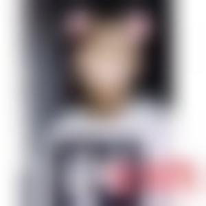 「成都润美玉之光医疗美容整形门诊部刘中国」怎么样?擅长|案例|价格表
