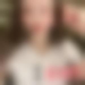 「成都润美玉之光医疗美容整形门诊部何芳」怎么样?擅长|案例|价格表
