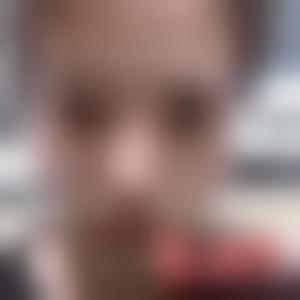 「北京丽都医疗美容医院杨斌」怎么样?擅长|案例|价格表