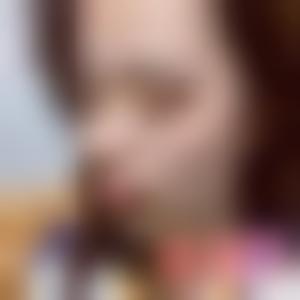 「北京丽都医疗美容医院杨斌」怎么样?擅长|案例|价格表