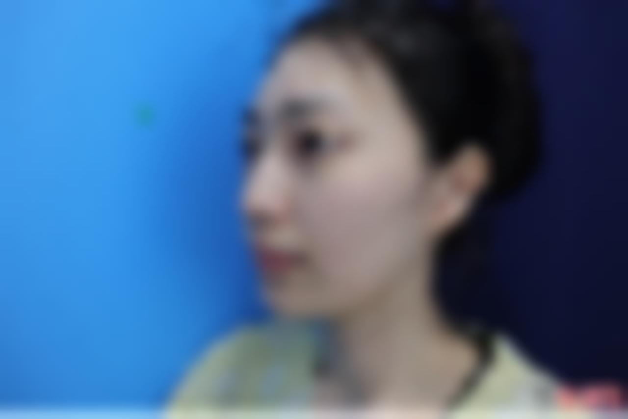 「成都铜雀台整形美容医院雷刚」怎么样?擅长|案例|价格表