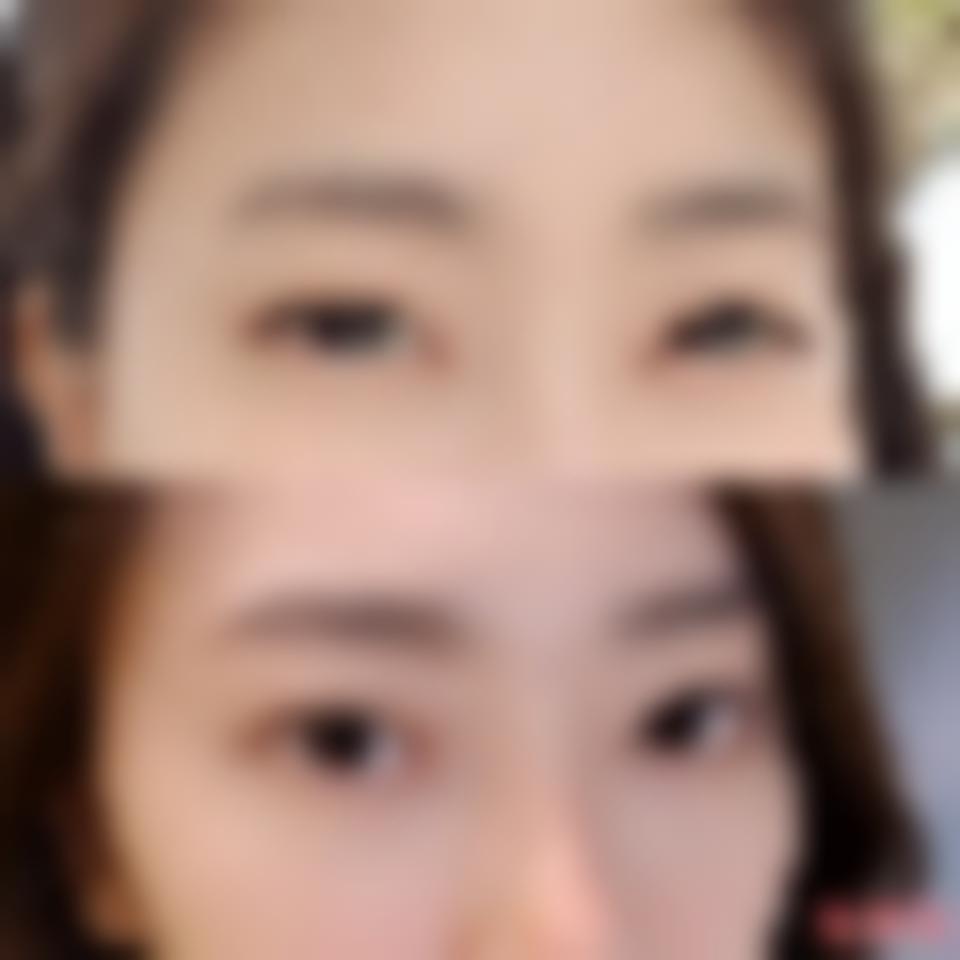 「成都铜雀台整形美容医院雷刚」怎么样?擅长|案例|价格表