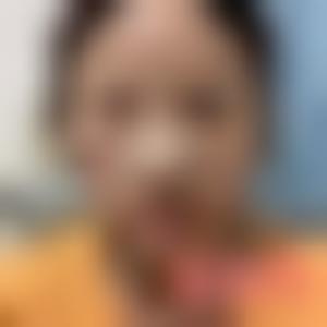 「广州华美医疗美容医院杨小红」怎么样?擅长|案例|价格表