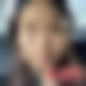 「广州华美医疗美容医院杨小红」怎么样?擅长|案例|价格表