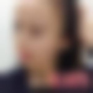 「长沙华韩华美医疗美容医院肖锋」怎么样?擅长|案例|价格表