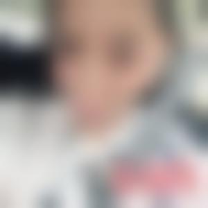 「北京丹熙医疗美容诊所罗汇东」怎么样?擅长|案例|价格表