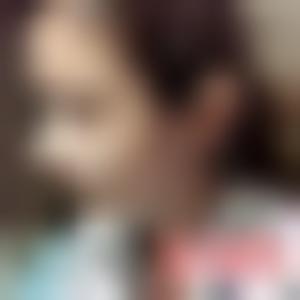 「长沙脸博士医疗美容门诊部廖洪跃」怎么样?擅长|案例|价格表