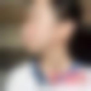 「长沙脸博士医疗美容门诊部曾垂绅」怎么样?擅长|案例|价格表