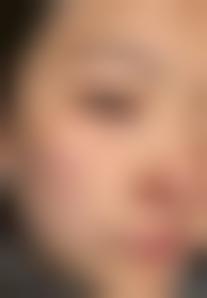 「成都市西区医院整形美容科」怎么样?正规吗|案例|价格表