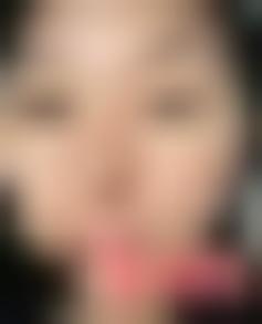 「成都市西区医院整形美容科」怎么样?正规吗|案例|价格表