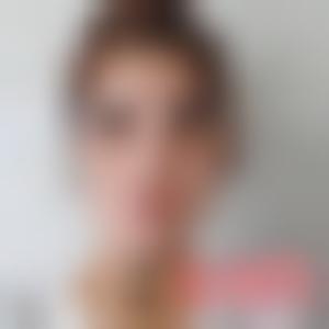 「北京卓新华星医疗美容门诊部陈雪」怎么样?擅长|案例|价格表