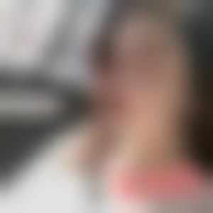 「北京美莱整形」怎么样?正规吗|案例|价格表