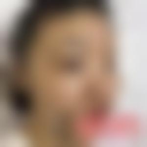 「北京美莱整形」怎么样?正规吗|案例|价格表