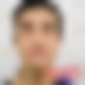 「北京美莱整形范元涛」怎么样?擅长|案例|价格表