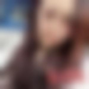 「成都美立方整形美容医院张娟」怎么样?擅长|案例|价格表