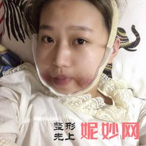 济南海峡美容整形医院是正规的吗?