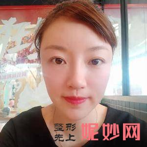 长沙爱思特医疗美容医院是正规的吗?附2021较新整形案例