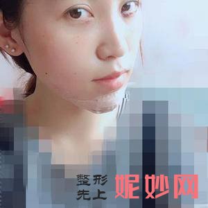 「北京安贞医院激光整形科」怎么样?正规吗|案例|价格表