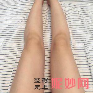 「北京安贞医院激光整形科」怎么样?正规吗|案例|价格表