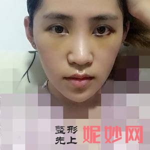 「北京安贞医院激光整形科」怎么样?正规吗|案例|价格表
