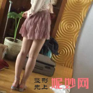 「北京安贞医院激光整形科」怎么样?正规吗|案例|价格表