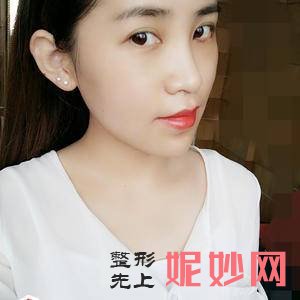 「北京安贞医院激光整形科」怎么样?正规吗|案例|价格表