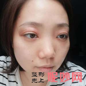 北京西美斯医疗美容诊所马勇光医生技术好不好_微晶磨削去法令纹技术好不好_坐诊时间